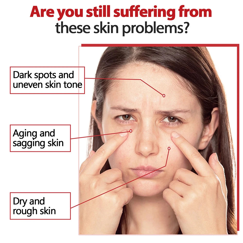 Crema ligera con ácido kójico y retinol
